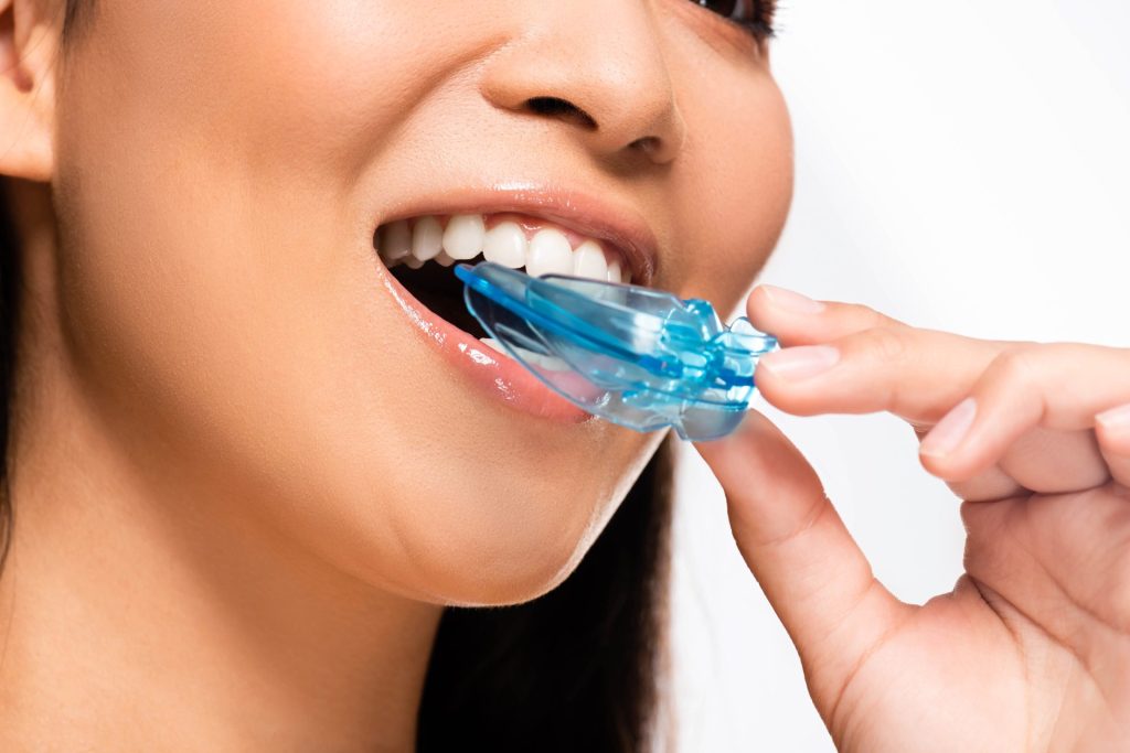 Signs You May Need A Mouthguard At Night