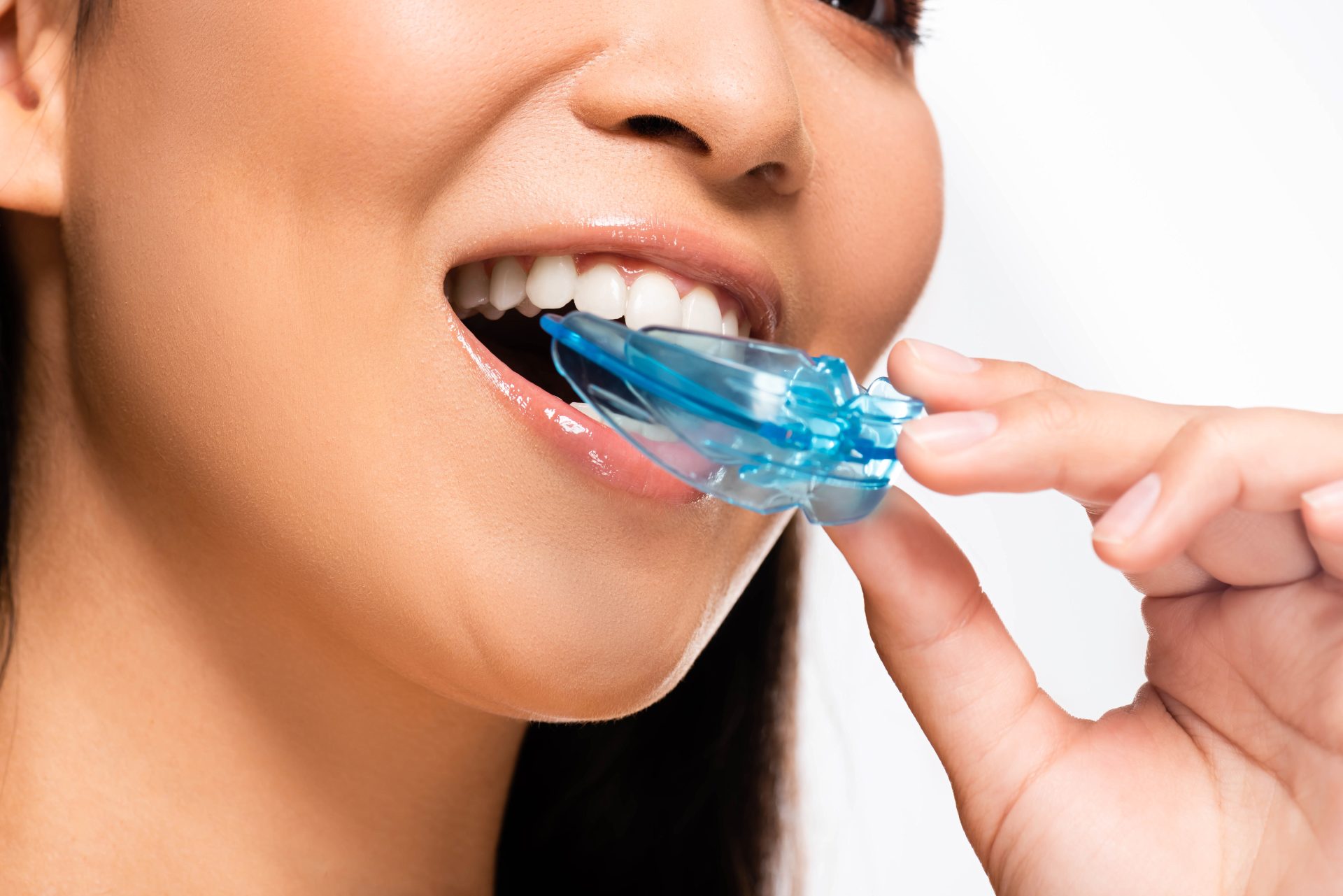 Signs You May Need A Mouthguard At Night