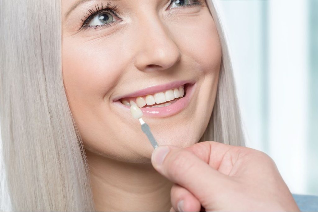 The Beverly Hills Smile: A Comprehensive Guide to Cosmetic Dentistry