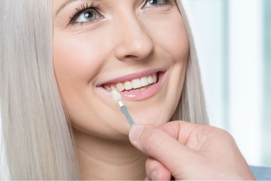 The Beverly Hills Smile: A Comprehensive Guide to Cosmetic Dentistry